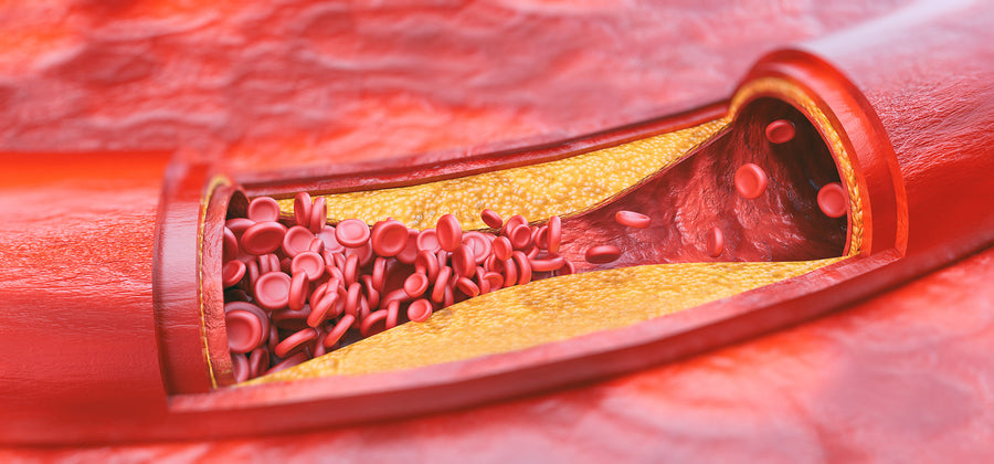 Is LDL Cholesterol Actually Bad for You? The Answer will Shock you